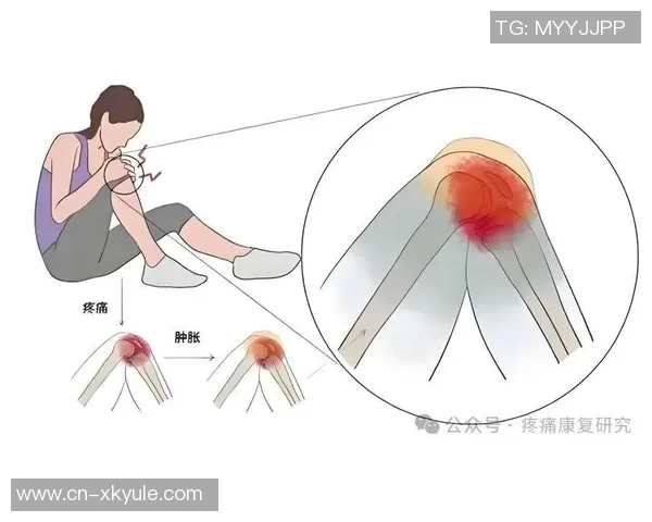 小卡34岁迎生涯首个50分表现ACL部分撕裂与半月板损伤影响膝盖健康